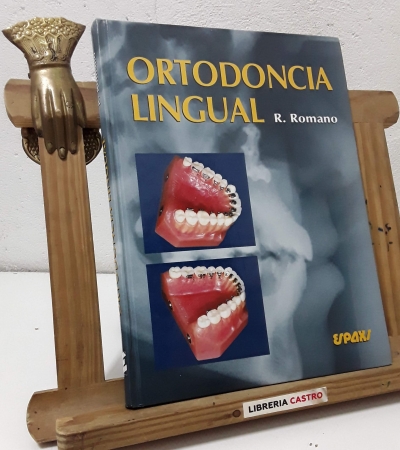 Ortodoncia lingual - Rafi Romano